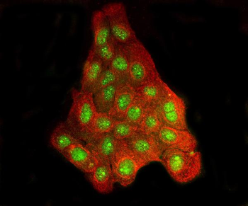 BRD2 Rabbit Polyclonal Antibody