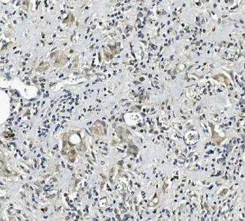 Calretinin/CALB2 Antibody