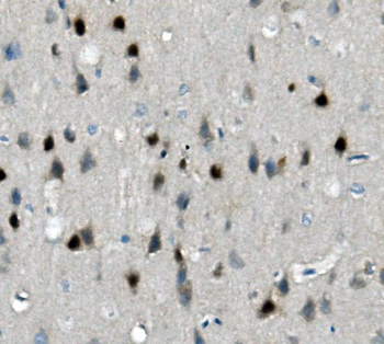 Calretinin/CALB2 Antibody