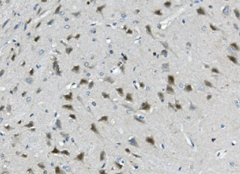 Calretinin/CALB2 Antibody