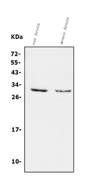 Calretinin/CALB2 Antibody
