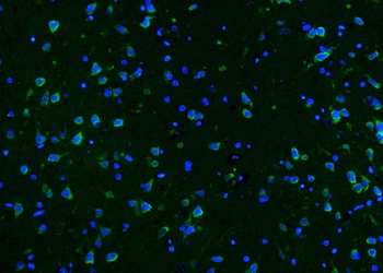 CaMKII alpha/CAMK2A Rabbit Polyclonal Antibody