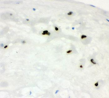 Cyclin E1/CCNE1 Rabbit Polyclonal Antibody