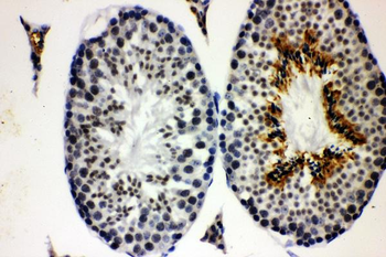 Cyclin E1/CCNE1 Rabbit Polyclonal Antibody