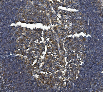 IL-3RB/Csf2rb/IL Rabbit Polyclonal Antibody