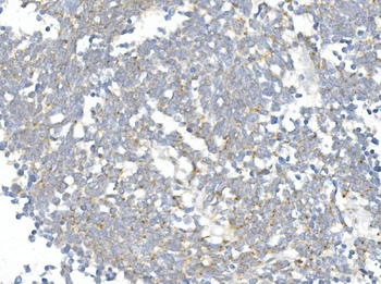 DDIT3 Rabbit Polyclonal Antibody