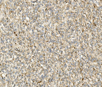DDIT3 Rabbit Polyclonal Antibody
