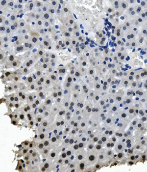 RNA Helicase A/DHX9 Antibody