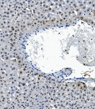 RNA Helicase A/DHX9 Antibody