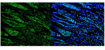 RNA Helicase A/DHX9 Antibody