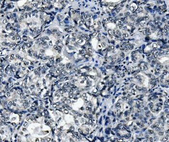 RNA Helicase A/DHX9 Antibody