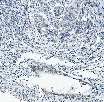 RNA Helicase A/DHX9 Antibody