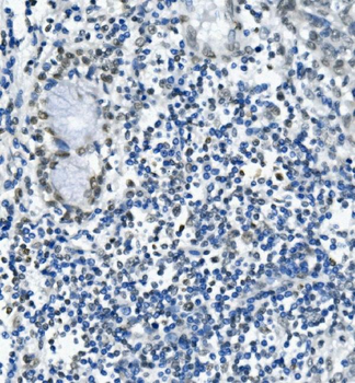 RNA Helicase A/DHX9 Antibody