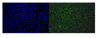 EAPP Rabbit Polyclonal Antibody