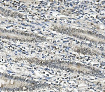 EAPP Rabbit Polyclonal Antibody