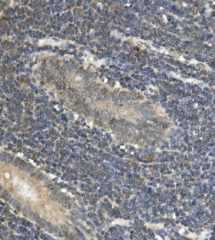 EAPP Rabbit Polyclonal Antibody