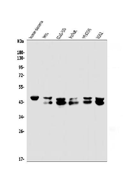 EAPP Rabbit Polyclonal Antibody