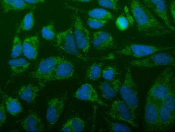 TTC11/FIS1 Rabbit Polyclonal Antibody