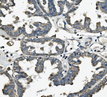 TTC11/FIS1 Rabbit Polyclonal Antibody