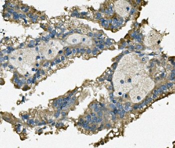 TTC11/FIS1 Rabbit Polyclonal Antibody