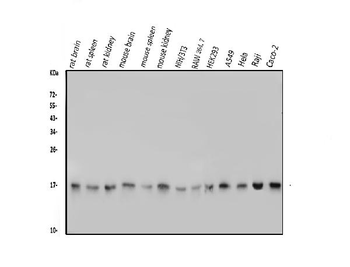 TTC11/FIS1 Rabbit Polyclonal Antibody