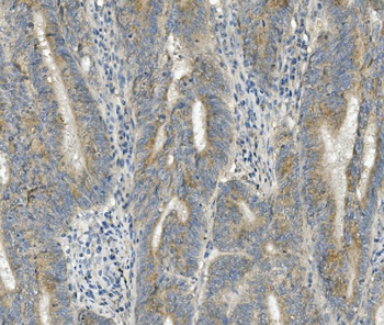 FRMD6/Willin Rabbit Polyclonal Antibody