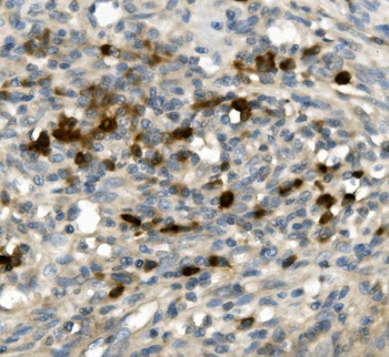 GFI1 Rabbit Polyclonal Antibody