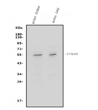IFN gamma Receptor beta/AF-1/IFNGR2/AF Rabbit Polyclonal Antibody