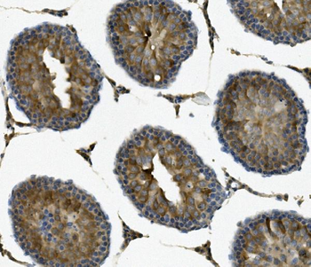 IFT88 Rabbit Polyclonal Antibody