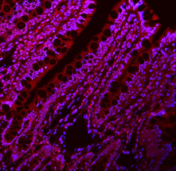 Lin28/LIN28A Rabbit Polyclonal Antibody