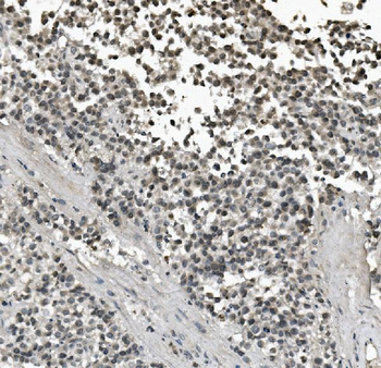 Lin28/LIN28A Rabbit Polyclonal Antibody