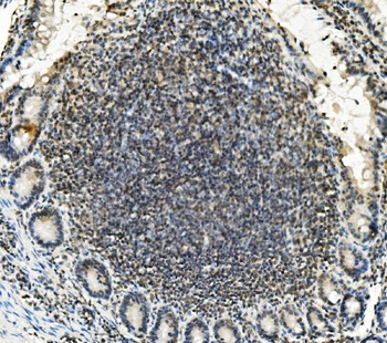 Lin28/LIN28A Rabbit Polyclonal Antibody