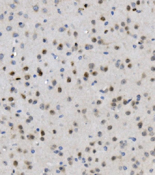 MBD4/MED1 Antibody