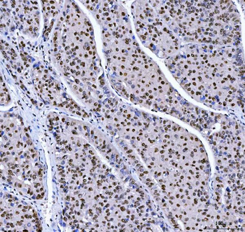 MBNL1 Rabbit Polyclonal Antibody