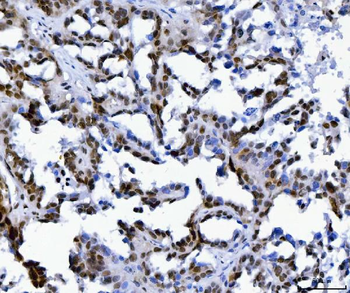 MBNL1 Rabbit Polyclonal Antibody