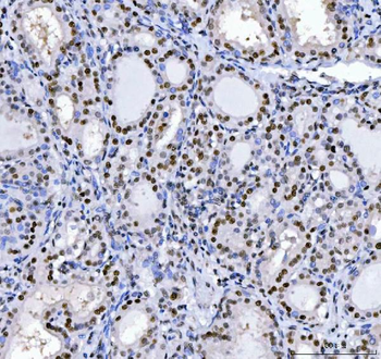 MBNL1 Rabbit Polyclonal Antibody