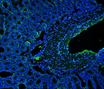 CD146/Mcam Rabbit Polyclonal Antibody