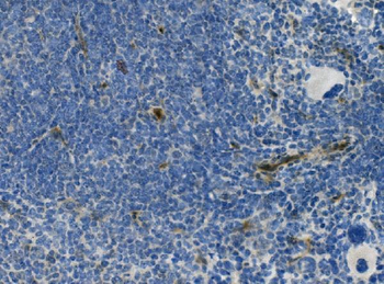 CD146/Mcam Rabbit Polyclonal Antibody