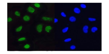 MCM5 Rabbit Polyclonal Antibody
