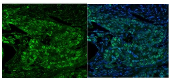 MCM5 Rabbit Polyclonal Antibody