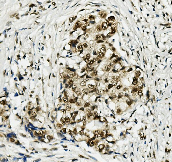 MCM5 Rabbit Polyclonal Antibody