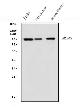 MCM5 Rabbit Polyclonal Antibody