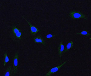 ME2 Rabbit Polyclonal Antibody