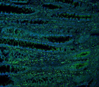 ME2 Rabbit Polyclonal Antibody