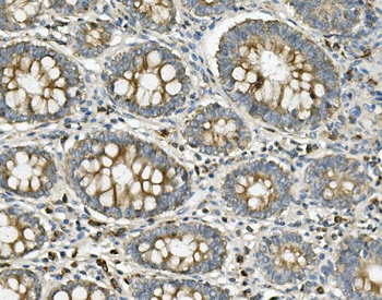 ME2 Rabbit Polyclonal Antibody