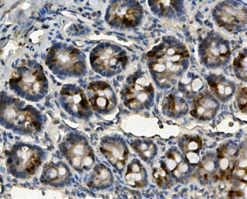 ME2 Rabbit Polyclonal Antibody