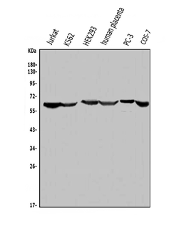 ME2 Rabbit Polyclonal Antibody