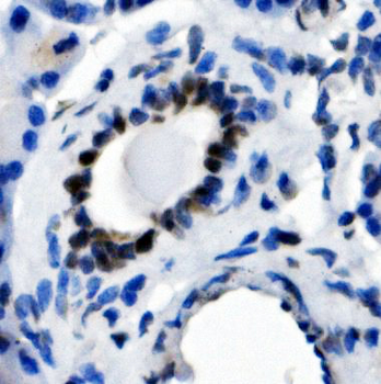 NFIC/CTF Rabbit Polyclonal Antibody