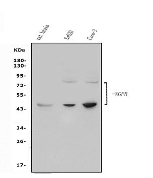 p75 NGF Receptor/NGFR Rabbit Polyclonal Antibody