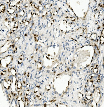 NOVA2 Rabbit Polyclonal Antibody